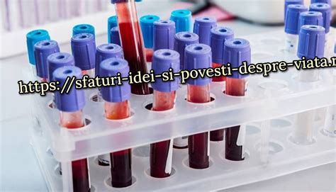 Regula efectuării unui test de sânge pentru zahăr și colesterol